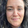 Image of Absoluter Joanne before taking Absolute Collagen, Marine Collagen Supplements